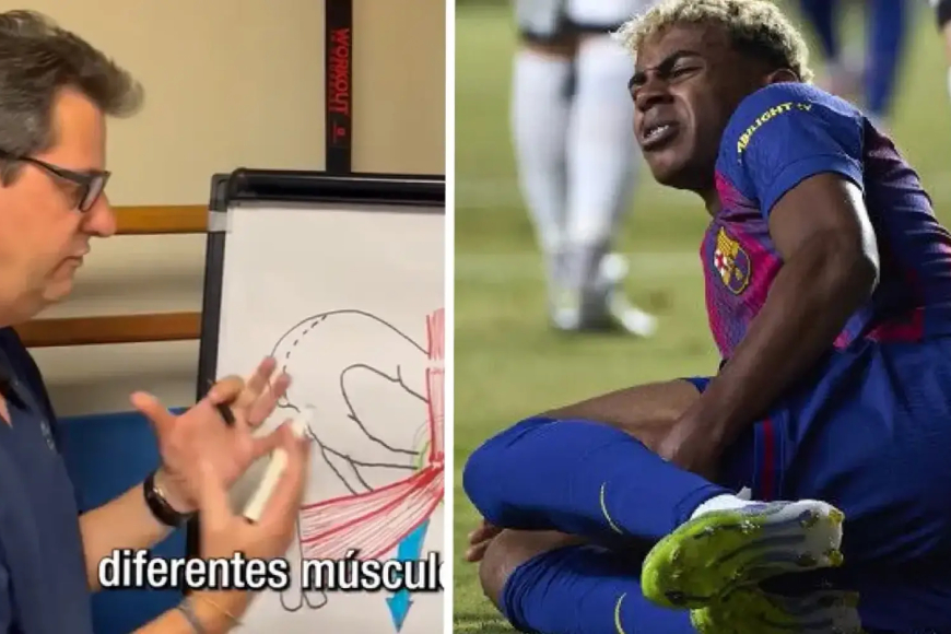 Barcelona Sweat Over Lamine Yamal’s Groin Injury as Comparisons to Messi Emerge